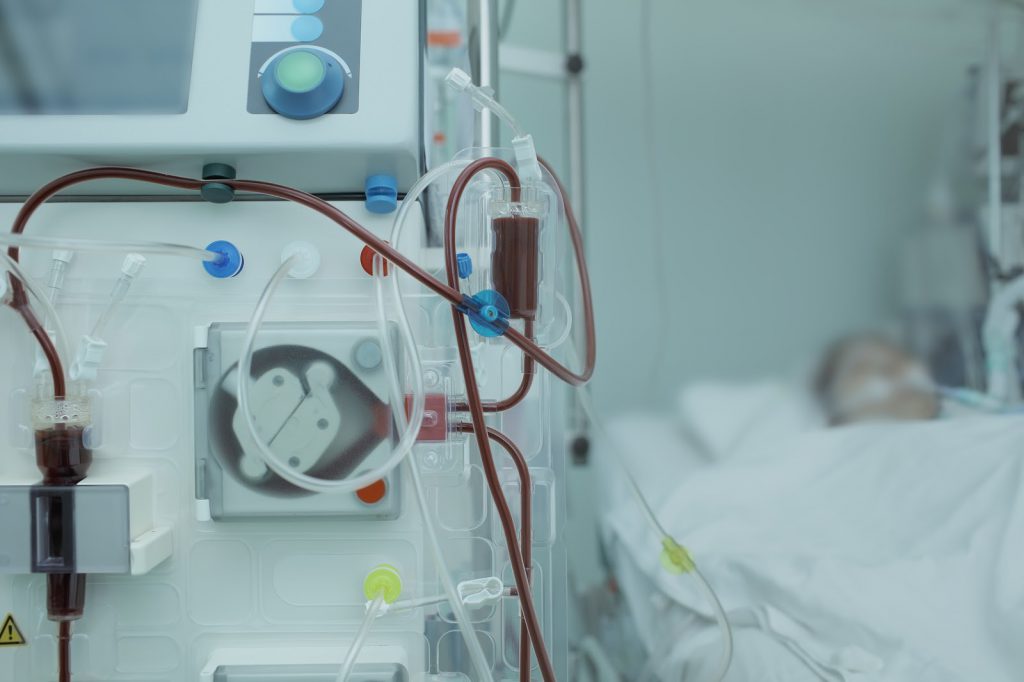 Hemodialysis apparatus connected to the patient in ICU.